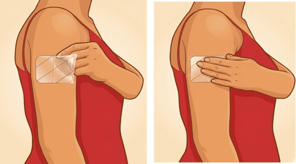 난소암 항암 부작용